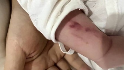 广西一男婴在月子中心被照料20天:身上2处骨折,育婴室监控无法查看