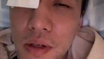 郭艾伦病床上接受采访 :医生说不会影响以后视力