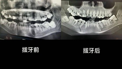 “痛到崩溃”!市卫健委回应“女子在医院跳楼”