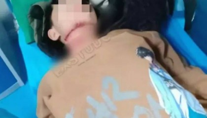 河南13岁被锁喉男孩赴京治疗后已脱离生命危险，拉绳老人已被采取刑事强制措施