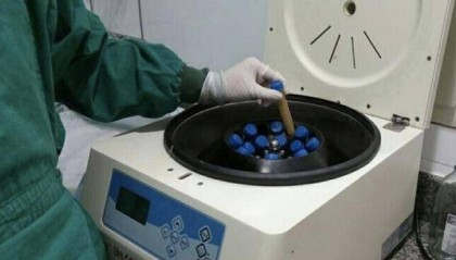 有偿捐粪，月入6000？粪便能制药，还能治肠病和抑郁症……